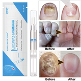 Advanced Fungal Nail Repair Pen
