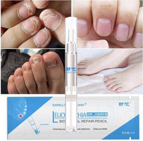 Advanced Fungal Nail Repair Pen