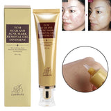 Acne Scar Removal Cream